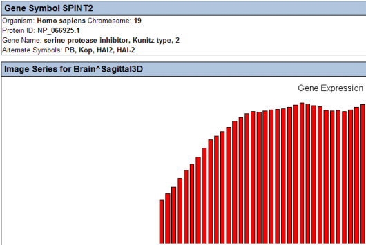 Pipeline Pilot Imaging 컬렉션을 활용한 뇌 MRI 분석 이미지-1