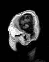 Pipeline Pilot Imaging 컬렉션을 활용한 뇌 MRI 분석 이미지-2